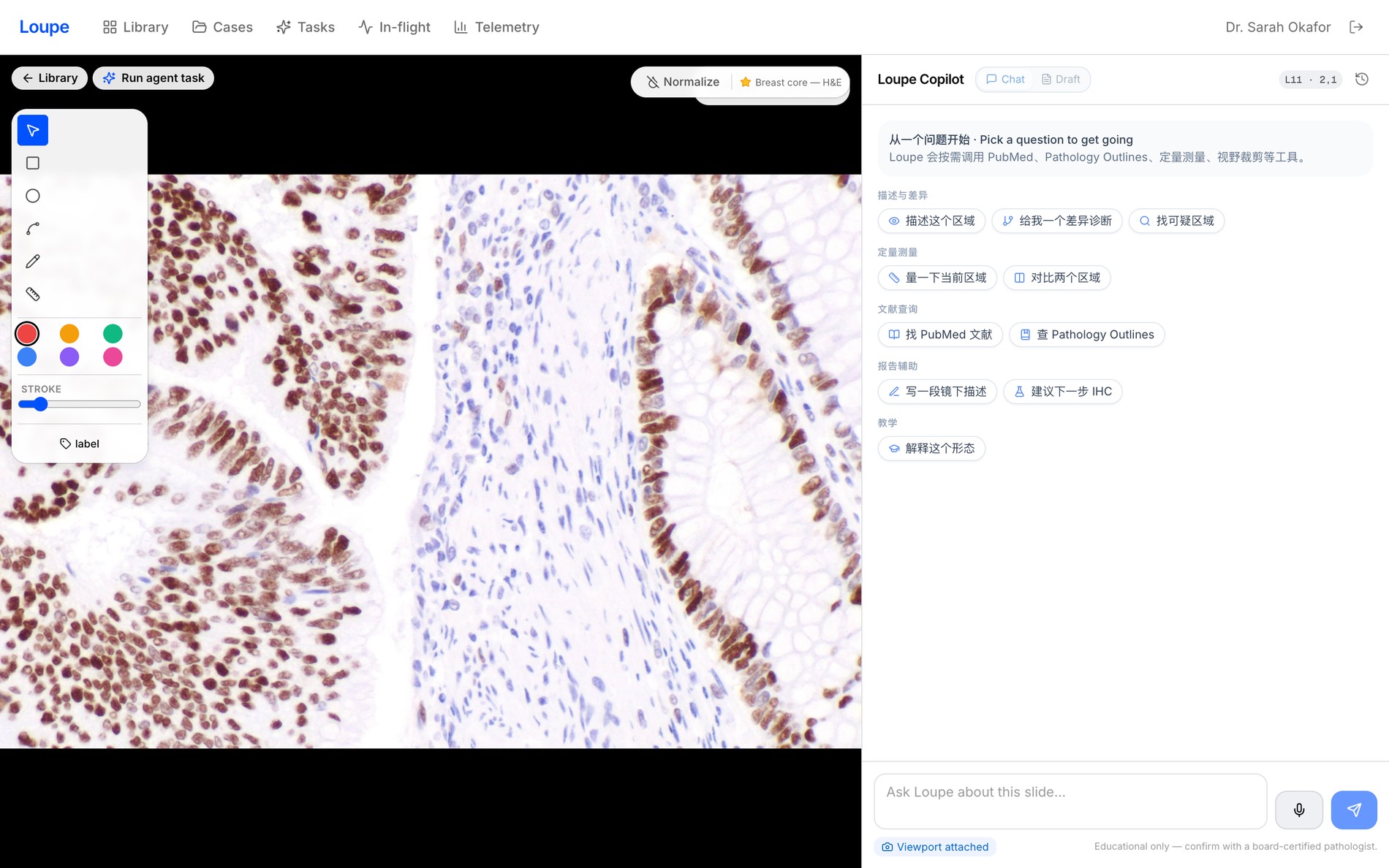 阅片台：标注、提问、IHC 量化 / Reading desk — annotate, ask, quantify IHC