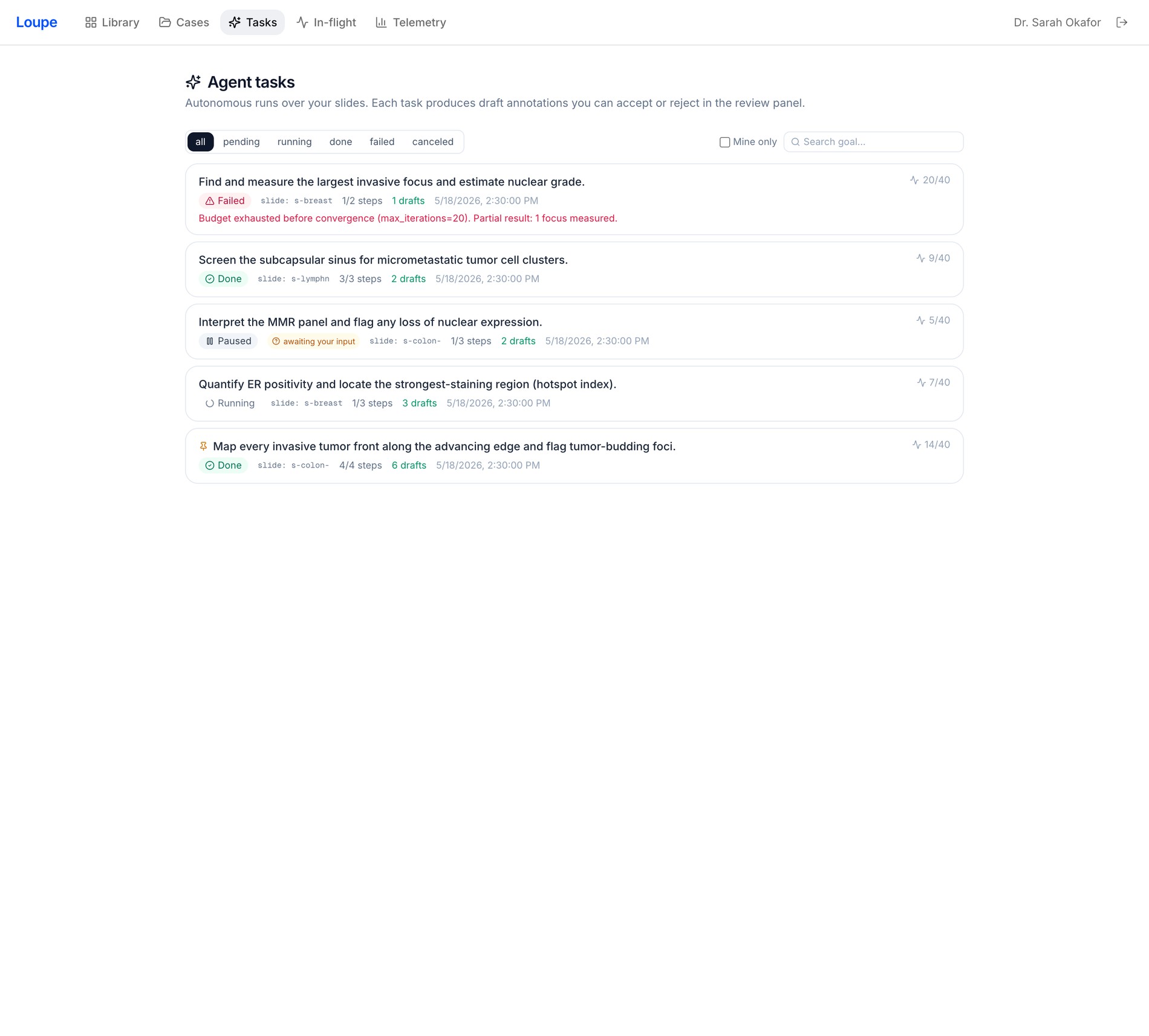agent tasks · the run lifecycle