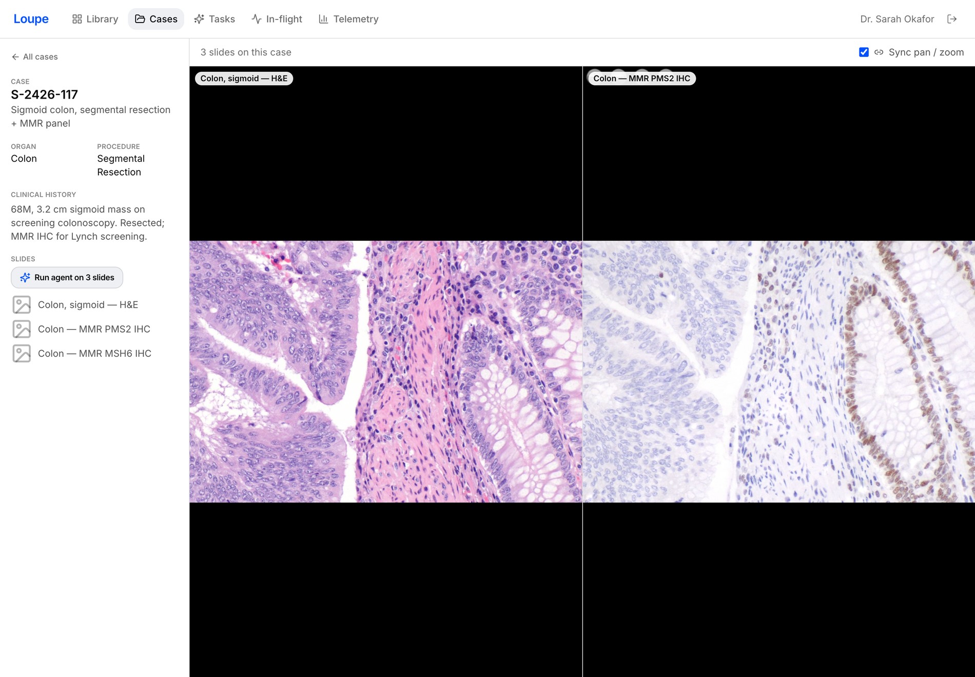 case · synced H&E + MMR IHC comparison