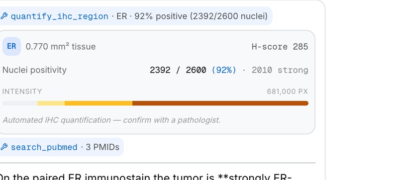 结构化 IHC 读数 / ER 92% (2392/2600), H-score 285