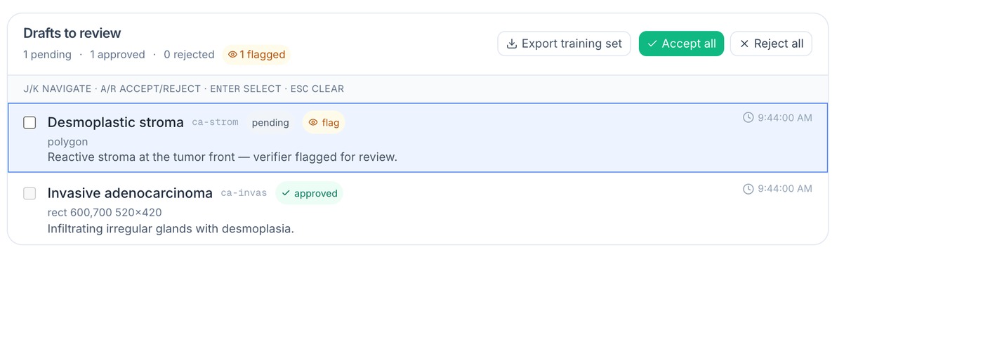 人审：接受 / 驳回 / 标记 / Accept · reject · verifier-flag